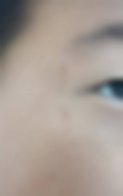 韩国延世sk整形医院设备仪器清单