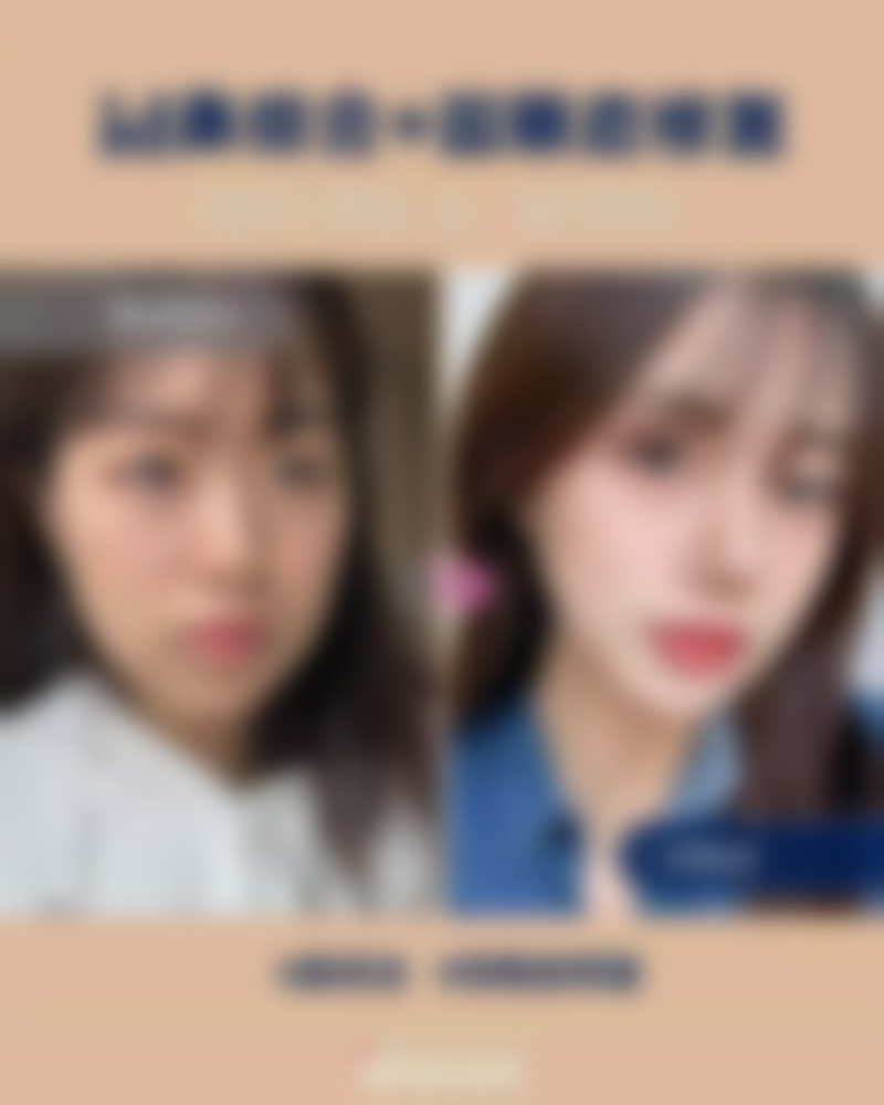 {全切双眼皮后吃什么消肿快？医生推荐5类消肿食物+3个护理妙招，7天快速消肿不反复！