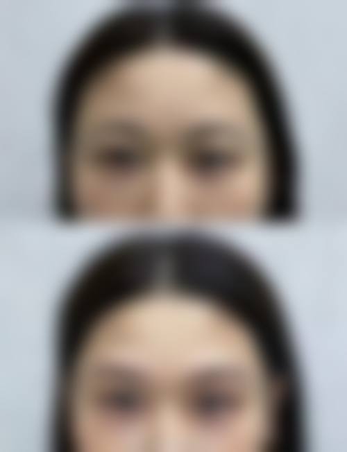 四、义乌恒美医疗美容诊所特色诊疗项目