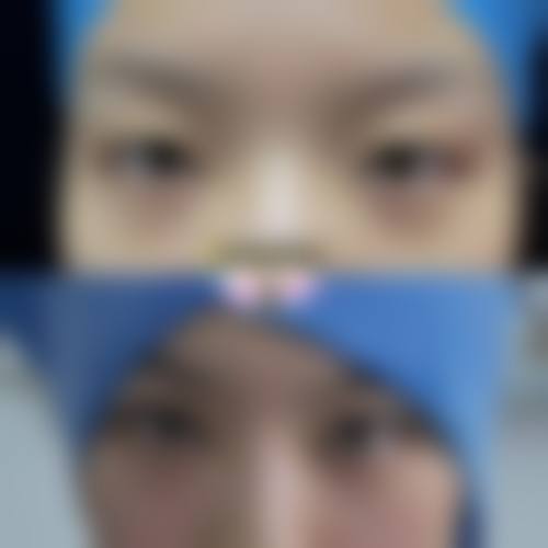 四、王超序医生收费价格