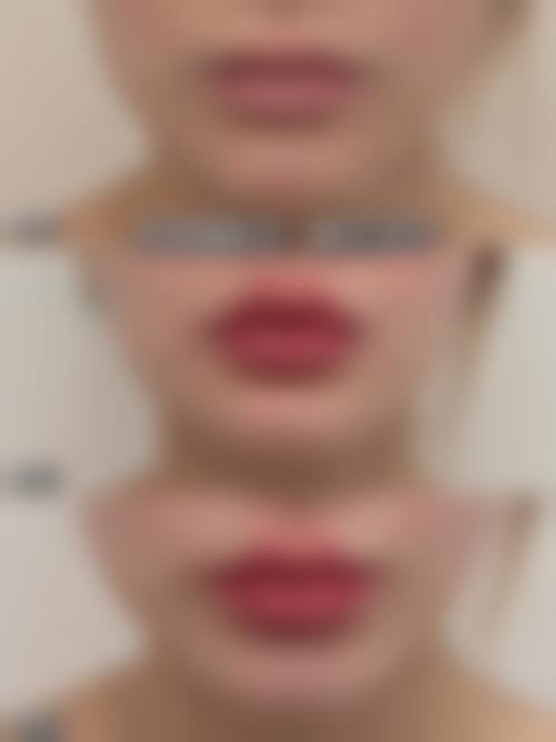 柳州臻潼彦医疗美容门诊部价格表/收费价格一览表