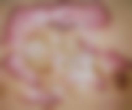 五、沈阳二0二医院整形美容科真实实例参考