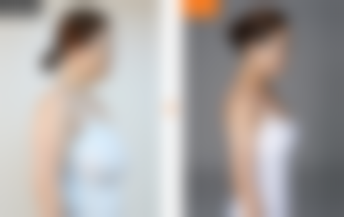 {假体隆胸能游泳吗？能！术后3月可游，假体稳固不影响蛙泳自由泳，医生建议循序渐进