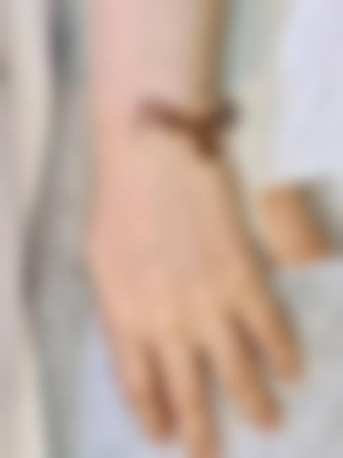 七、就诊流程与注意事项（术前术后）