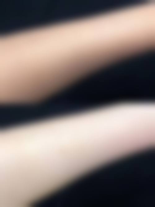 十、相关科普内容推荐——传统吸脂瘦腰腹