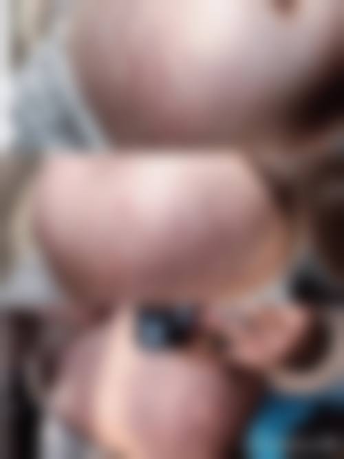 七、宁波海曙清媛(爱美丽)医疗美容诊所激光美肤技术怎么样