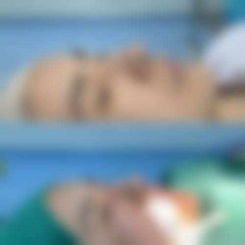 {隆鼻鼻夹要戴多久？医生强调：至少7天！塑形消肿防增生，3阶段指南在此