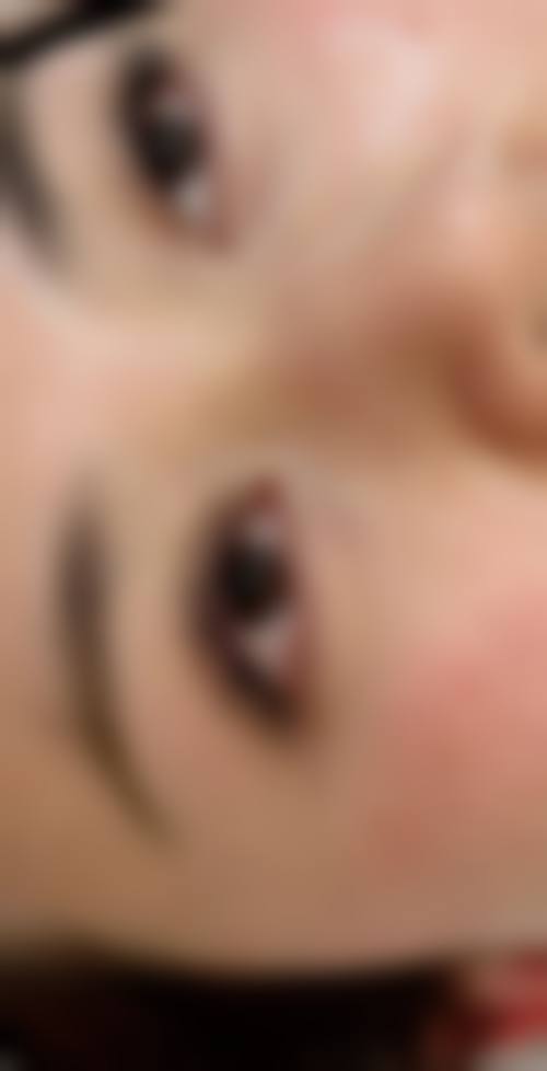 2、头发移植（FUE无痕植发）核心技术优势