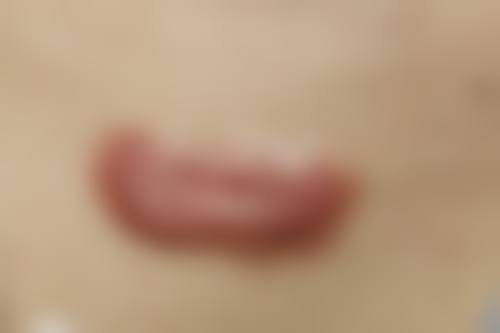 十四、太原滨菲颂雅医疗美容诊所患者常见问答