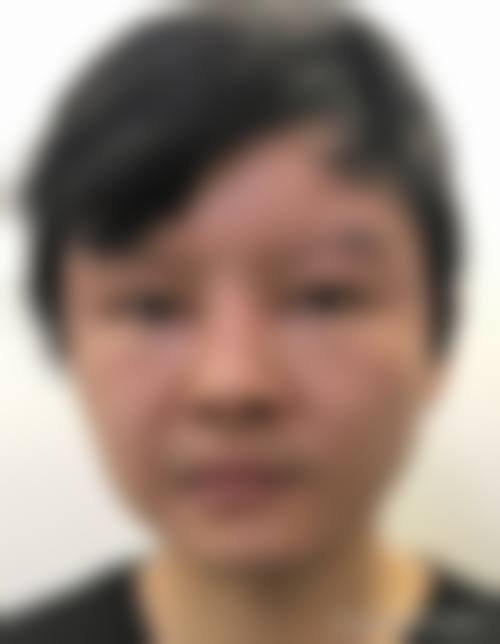 八、患者常见问题解答（精选 ）