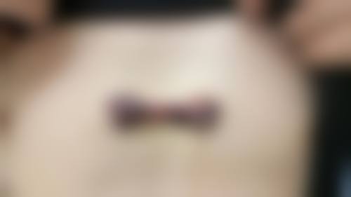 泰州艾菲诗医疗美容门诊部口碑如何？来看患者真实评价