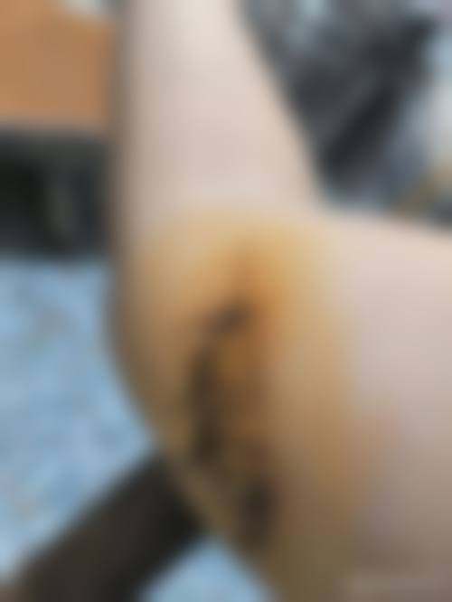 患者常见问题解答（精选 ）