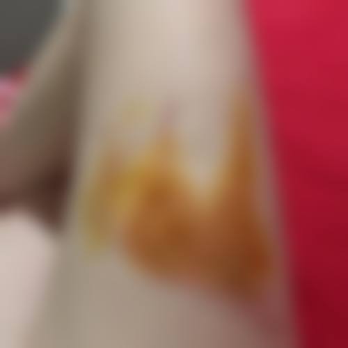 佛山丝奈爱美仕整形医院价格表