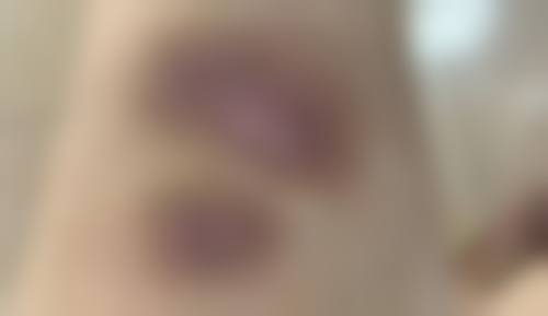 佛山丝奈爱美仕整形医院口碑如何