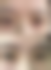 三、谢文斌医生做手术价格：