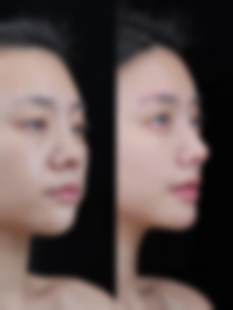 八、张小红医生预约挂号指南