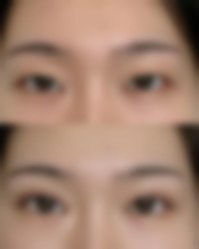 三、秦顺峰医生擅长项目与适合人群