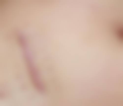 成都伊生美医疗美容医院特色诊疗项目