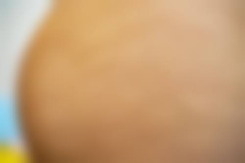 八、患者常见问题解答（精选 ）