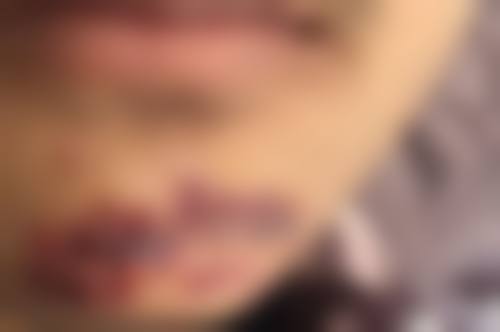 三、邹城大华艺美医疗美容门诊部开展项目