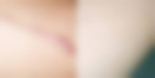 去除疤痕增生的成效如何