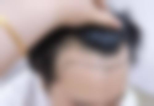 三、金长旭医生技术水平高