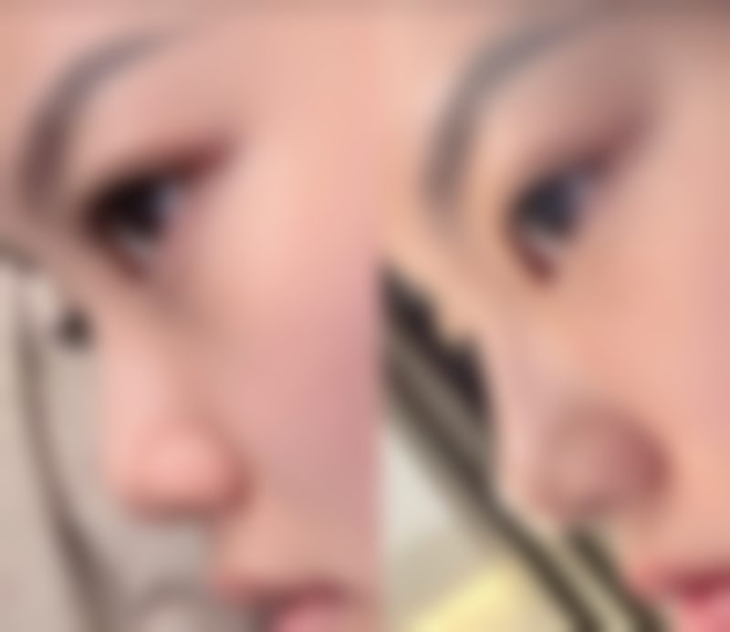 二、金长旭医生擅长项目