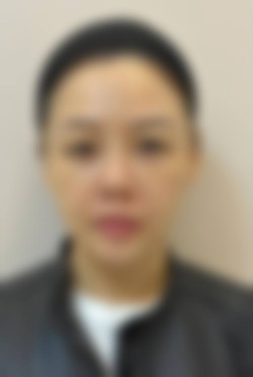 十、相关科普内容推荐：面部除皱抗衰治疗全解析