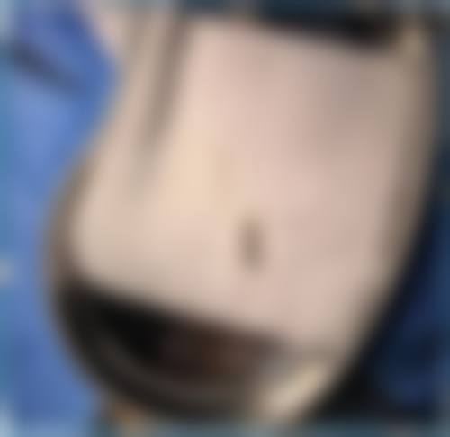 四、郑州屈小丽整形医院特色诊疗项目及技术优势