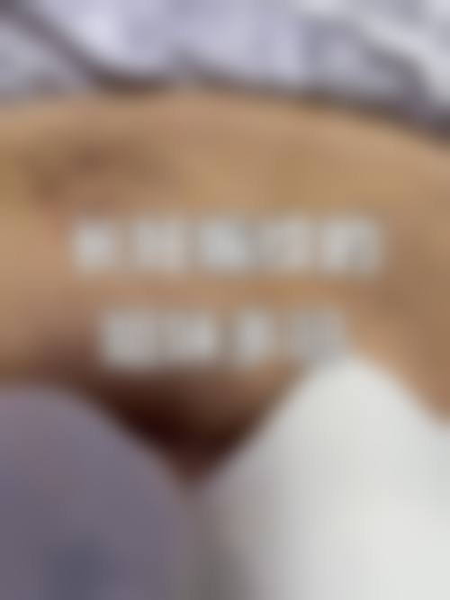 十四、莱芜惟美医疗美容诊所患者常见问答