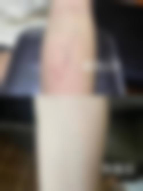 李正根医生擅长项目