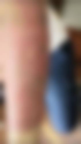 李正根医生技术优势