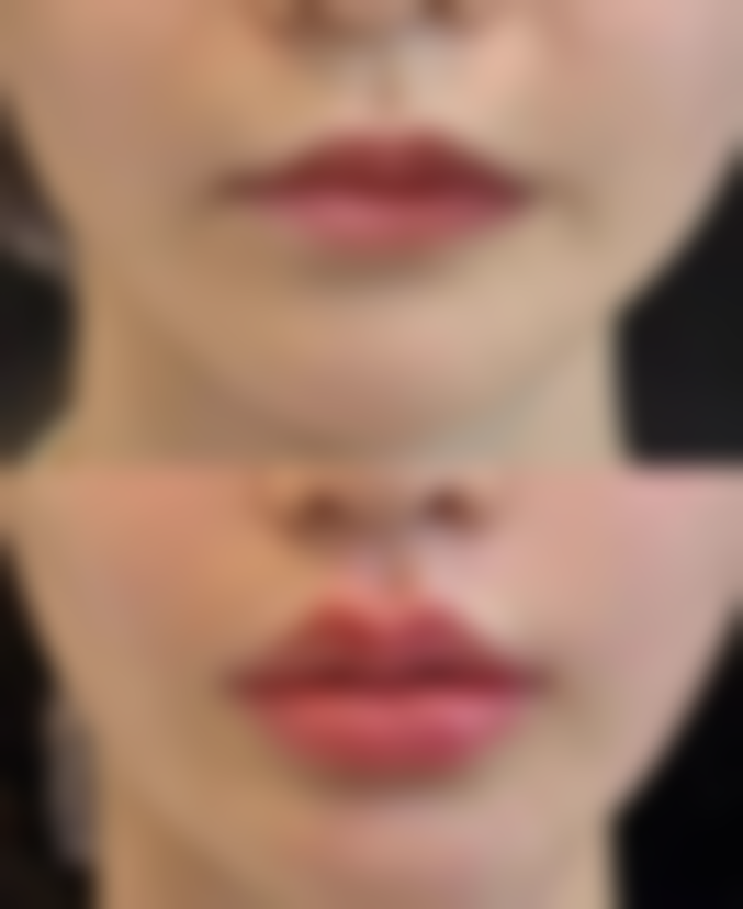 五、赖云建医生坐诊哪个医院？