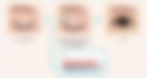 七、韩国MGTY整形外科收费标准2026参考