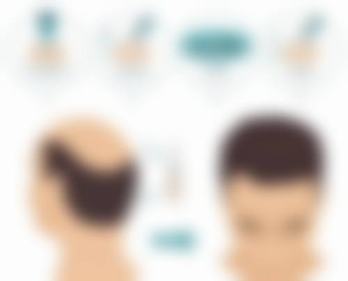 十五、成都西部中西医结合医院整形科患者常见问答