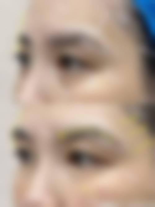 九、韩国MGTY整形外科到院交通路线