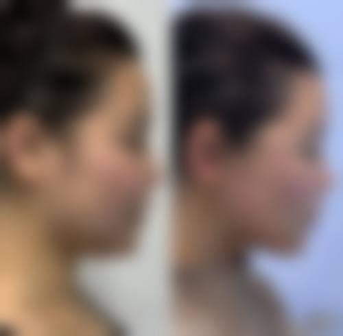 四、陈咏玲医生口碑评价好