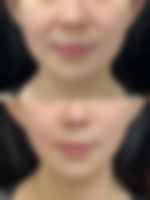 十四、成都西部中西医结合医院整形科口碑评价