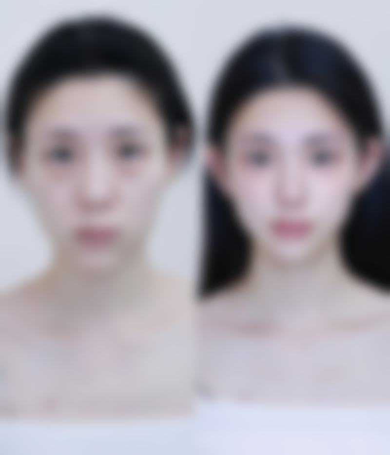 二、陈咏玲擅长项目及优势