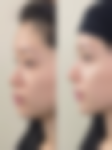 三、陈咏玲医生做手术价格