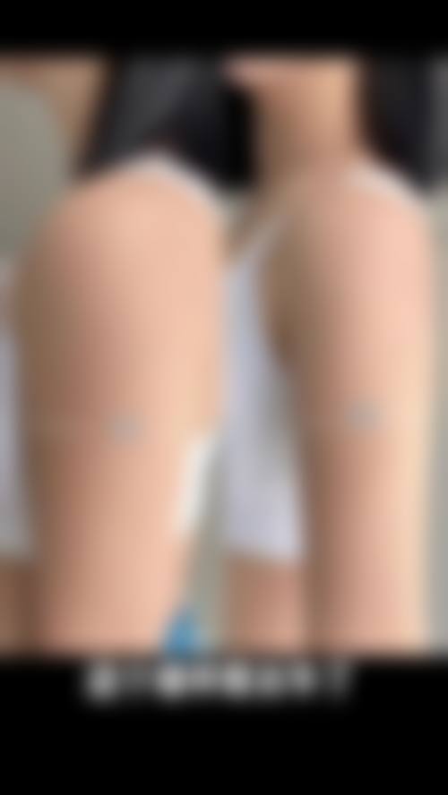 {腹部抽脂可以瘦吗？效果明显能减重5-8cm，医生揭秘维持10年不反弹的秘诀！