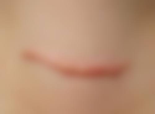 阜阳新时代美容整形门诊部口碑如何？来看患者真实评价