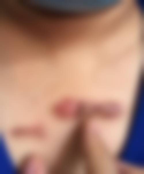 五. 西安富隆光知美医疗美容诊费用明细表