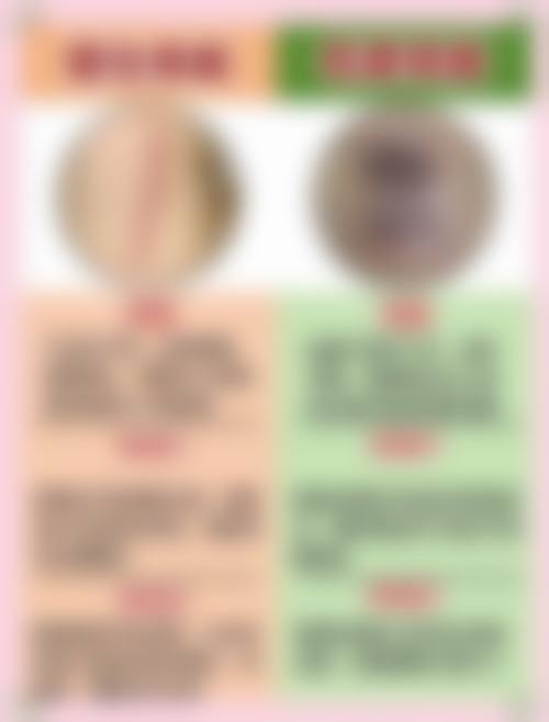 就医提示，拆线后如何除疤痕更专精