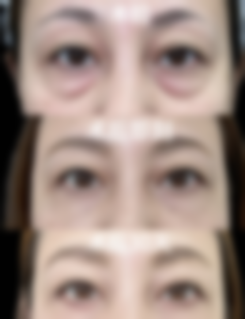 8、患者常见问题解答（精选 ）