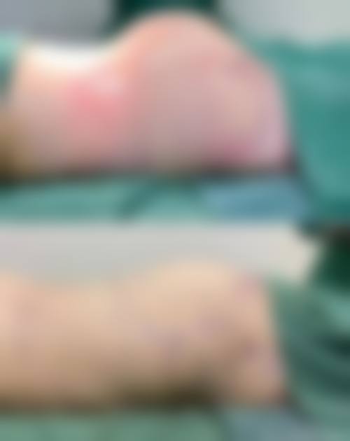 三、张魁医生技术水平高吗?