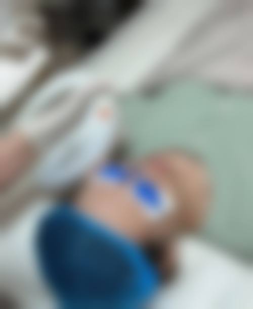 二十多年的疤痕激光能去掉吗之真实实例分享