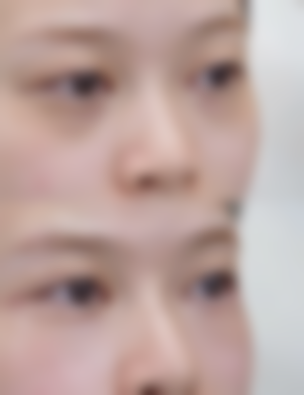 七、张魁医生整形项目价格表/收费标准一览(2026年全新)