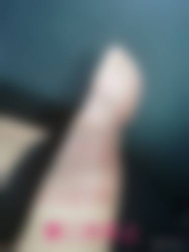 八、患者常见问题解答（精选 ）