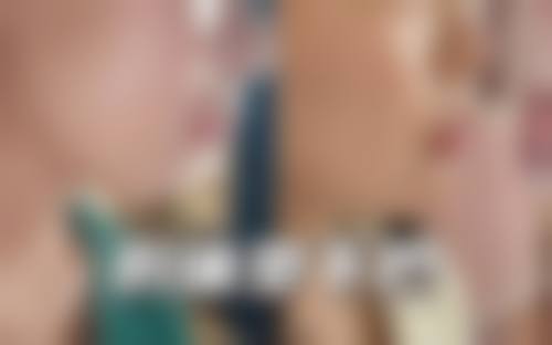 8、深圳流花医院医疗美容科价格表/收费区间参考